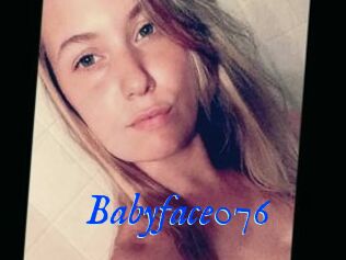 Babyface076